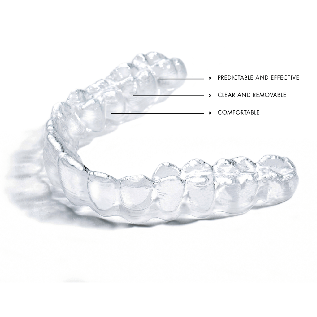 QD Active Aligners' simplified aligner solution